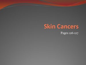 Skin Cancers Pages 126 127 ABCD Rule A