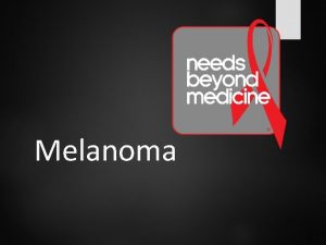 Melanoma Skin Cancer Most common type of cancer
