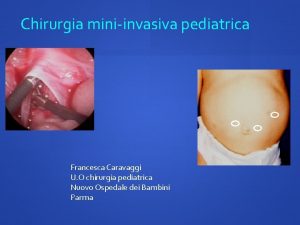 Chirurgia miniinvasiva pediatrica Francesca Caravaggi U O chirurgia
