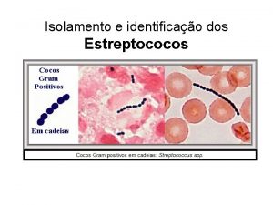 Isolamento e identificao dos Estreptococos Importncia clnica dos