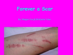 Forever a Scar By Megan Fox Brittanie Yoke