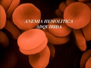 ANEMIA HEMOLITICA ADQUIRIDA ANEMIA HEMOLITICA Las anemias hemolticas