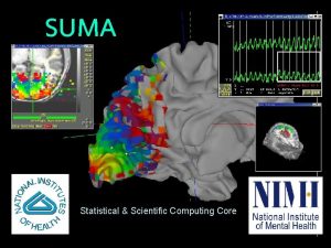 SUMA Statistical Scientific Computing Core 722004 SSCCNIMH 722004