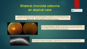 Bilateral choroidal osteoma an atypical case A 54