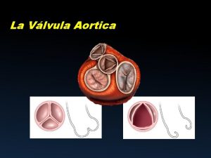La Vlvula Aortica Unin sinotubular VD Seno de