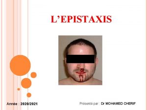 LEPISTAXIS Anne 20202021 Prsent par Dr MOHAMED CHERIF