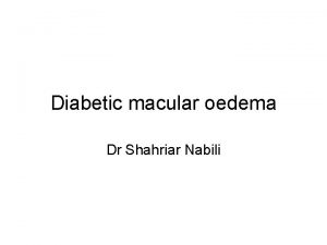 Diabetic macular oedema Dr Shahriar Nabili DMO Macular