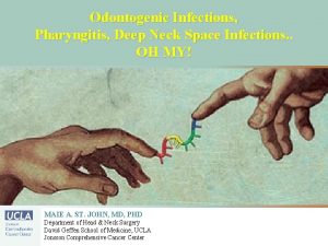 Odontogenic Infections Pharyngitis Deep Neck Space Infections OH