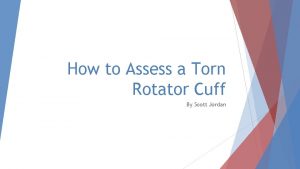 How to Assess a Torn Rotator Cuff By