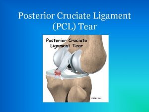 Posterior Cruciate Ligament PCL Tear Development of PCL