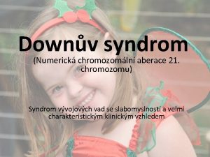 Downv syndrom Numerick chromozomln aberace 21 chromozomu Syndrom