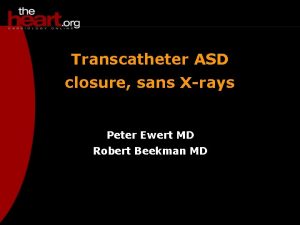 Transcatheter ASD closure sans Xrays Peter Ewert MD