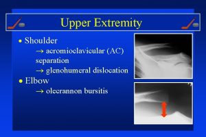 Upper Extremity Shoulder acromioclavicular AC separation glenohumeral dislocation