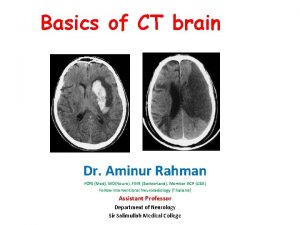 Basics of CT brain Dr Aminur Rahman FCPS