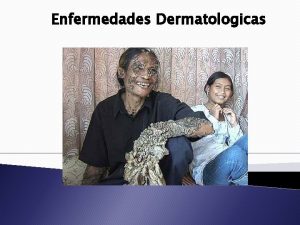 Enfermedades Dermatologicas Eczema Eczema Es un trmino general