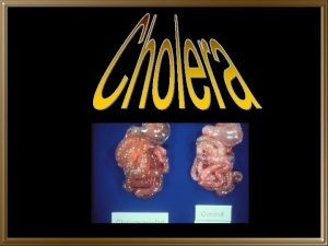 What is Cholera Cholera is an acute intestinal