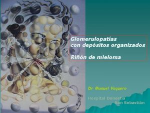 Glomerulopatas con depsitos organizados Rin de mieloma Dr