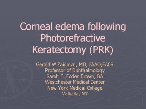 Corneal edema following Photorefractive Keratectomy PRK Gerald W