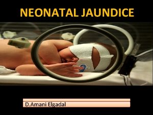 NEONATAL JAUNDICE D Amani Elgadal Objectives Understand etiology