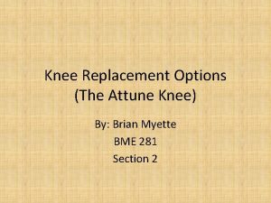 Knee Replacement Options The Attune Knee By Brian