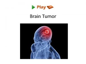 Brain Tumor Introduction A tumor is a mass