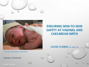 ENSURING SKINTOSKIN SAFETY AT VAGINAL AND CAESAREAN BIRTH