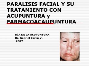 PARALISIS FACIAL Y SU TRATAMIENTO CON ACUPUNTURA y