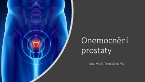 Onemocnn prostaty Doc MUDr Tom Grus Ph D