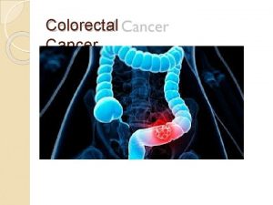 Colorectal Cancer Definitio nColorectal Cancer is the cancer