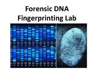 Forensic DNA Fingerprinting Lab Lab Objectives Use restriction