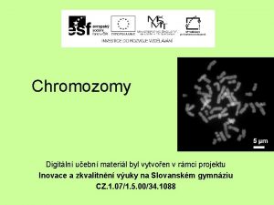 Chromozomy Digitln uebn materil byl vytvoen v rmci