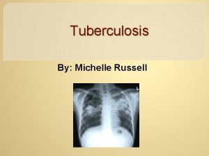 Tuberculosis By Michelle Russell Objectives To become familiar