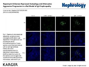 Rapamycin Enhances Repressed Autophagy and Attenuates Aggressive Progression