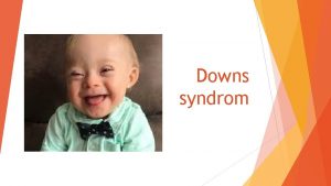 Downs syndrom Downs syndrom r den vanligaste enskilda