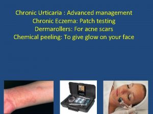 Chronic Urticaria Advanced management Chronic Eczema Patch testing