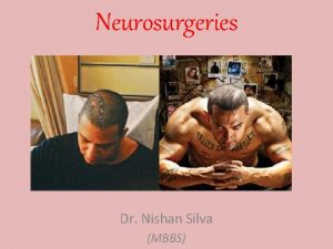 Neurosurgeries Dr Nishan Silva MBBS Head Injuries mechanism