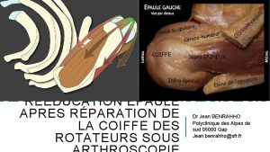 RDUCATION EPAULE APRES RPARATION DE LA COIFFE DES