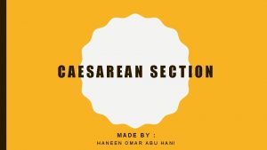 CAESAREAN SECTION MADE BY HANEEN OMAR ABU HANI