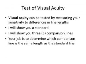 Test of Visual Acuity Visual acuity can be