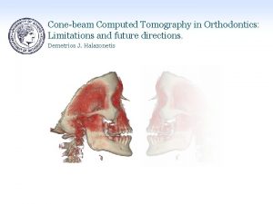 Conebeam Computed Tomography in Orthodontics Limitations and future