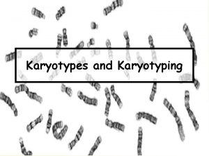 Karyotypes and Karyotyping What Are They A karyotype