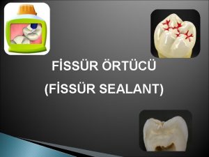 FSSR RTC FSSR SEALANT FSSR RTCLERN ENDKASYONLARI Hastaya