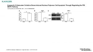 Aquaporin3 Attenuates Oxidative StressInduced Nucleus Pulposus Cell Apoptosis