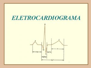 ELETROCARDIOGRAMA O ciclo cardaco PRINCPIO DE UM REGISTRO