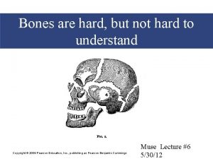Bones are hard but not hard to understand