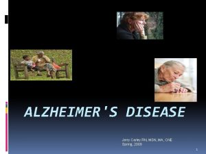 ALZHEIMERS DISEASE Jerry Carley RN MSN MA CNE