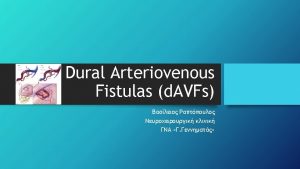 Definition Abnormal arteriovenous shunts within the dural leaflets