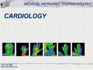MEDICAL INFRARED THERMOGRAPHY CARDIOLOGY EDP Srl 2004 http