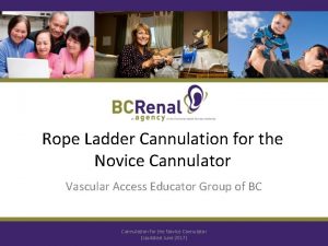Rope Ladder Cannulation for the Novice Cannulator Vascular