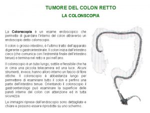 TUMORE DEL COLON RETTO LA COLONSCOPIA La Colonscopia